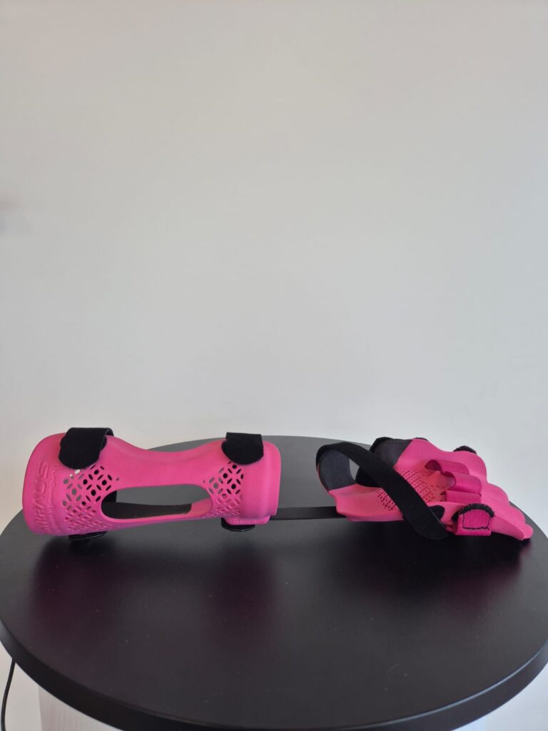 Orthopaedietechnik_Kraus_Kinder_Orthesen_00001