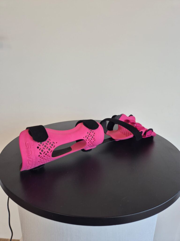 Orthopaedietechnik_Kraus_Kinder_Orthesen_00002