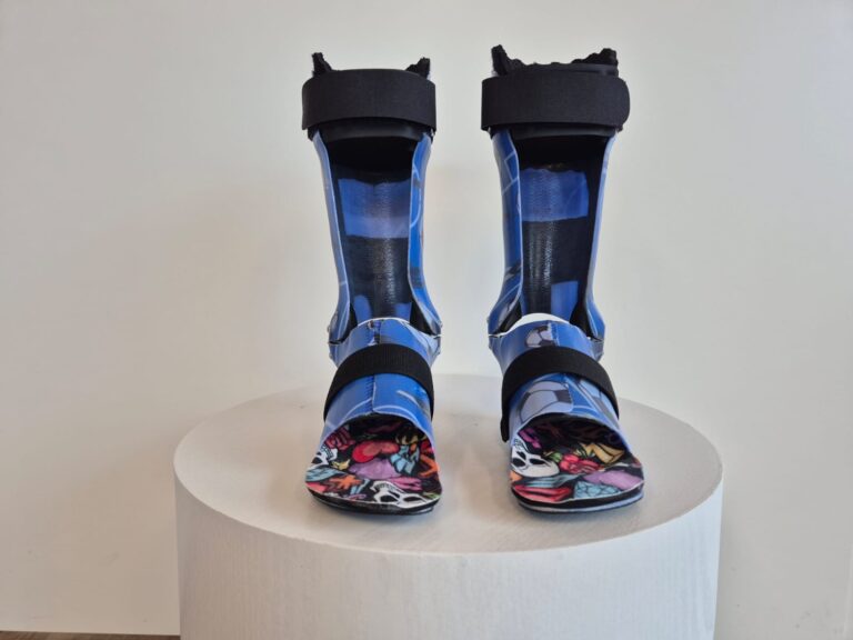 Orthopaedietechnik_Kraus_Kinder_Orthesen_00005