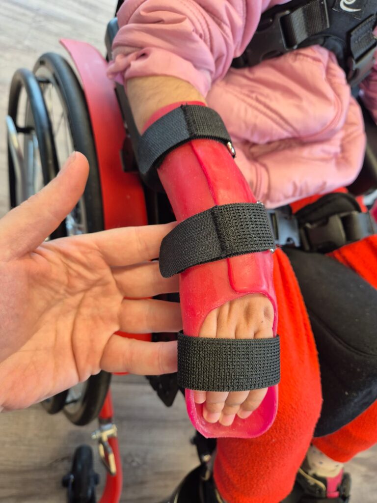 Orthopaedietechnik_Kraus_Orthesen_00004