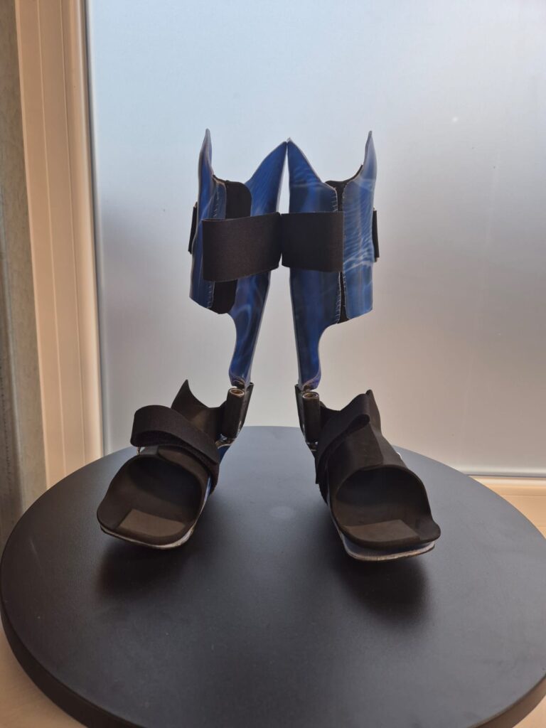 Orthopaedietechnik_Kraus_Orthesen_00006