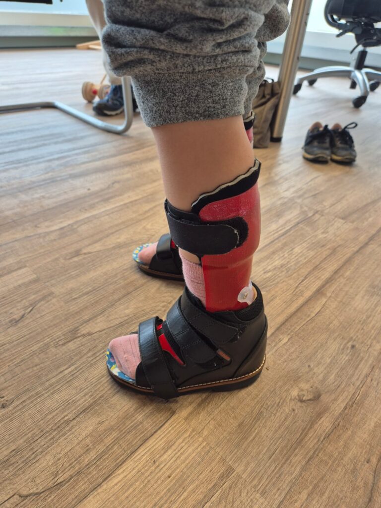 Orthopaedietechnik_Kraus_Orthesen_00007