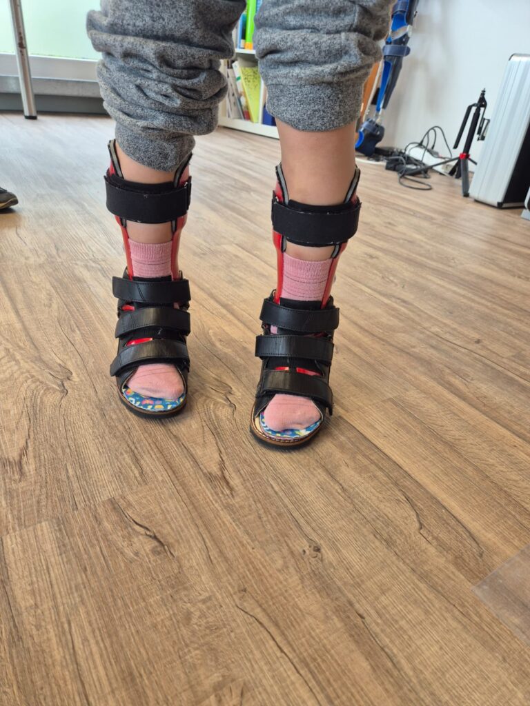 Orthopaedietechnik_Kraus_Orthesen_00008