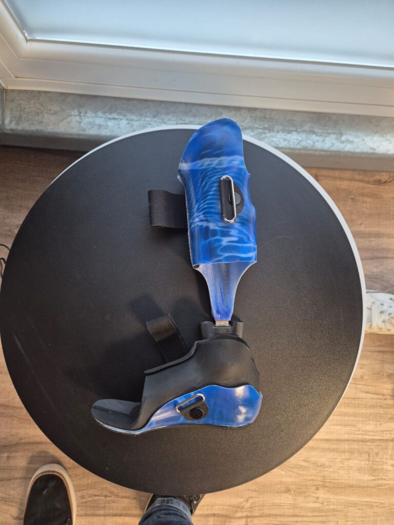 Orthopaedietechnik_Kraus_Orthesen_00009